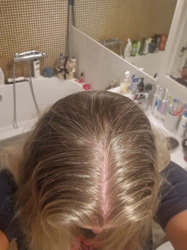 Customer photo review of Sunkissed Starter Kit