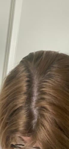 Customer photo review of Sunkissed Starter Kit