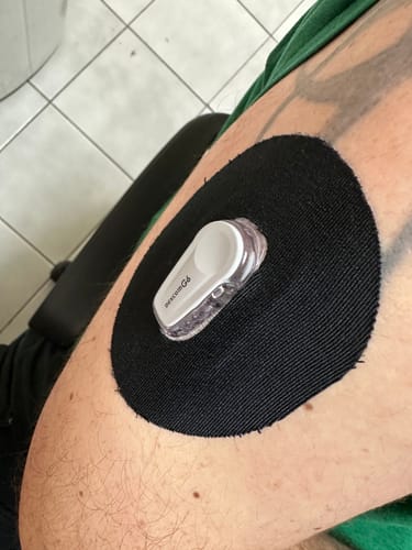 Customer photo review of Skin Grip Original - Dexcom G6 Patches
