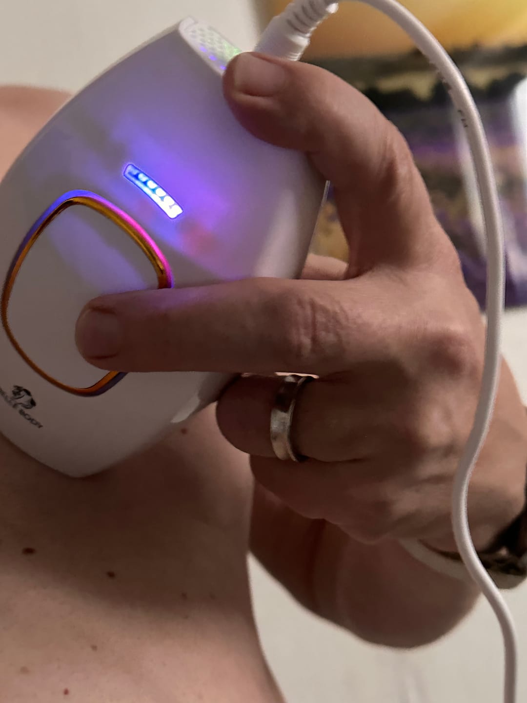 Customer photo review of Belle Body IPL Ultra+