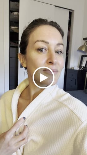Customer video review of WrinkleFix: Unlimited Toxins Membership Auto renew