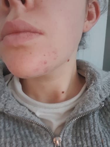 Customer photo review of Nourishing Bar - Guayaba & Maiz