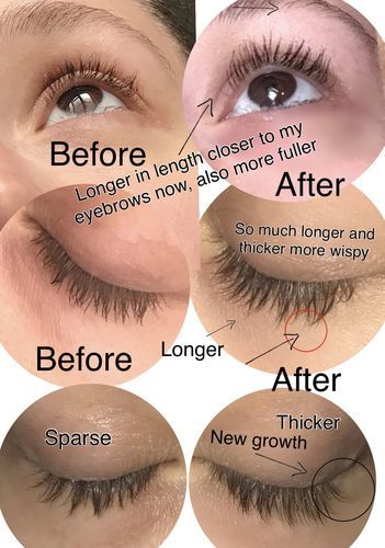 Customer photo review of Eyelash Serum