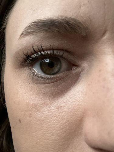 Customer photo review of Eyelash Serum