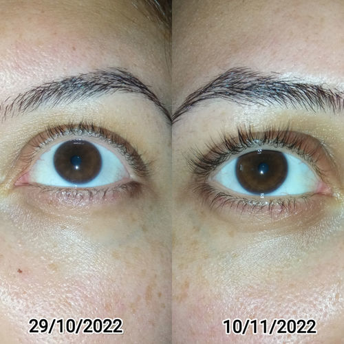 Customer photo review of Eyelash Serum