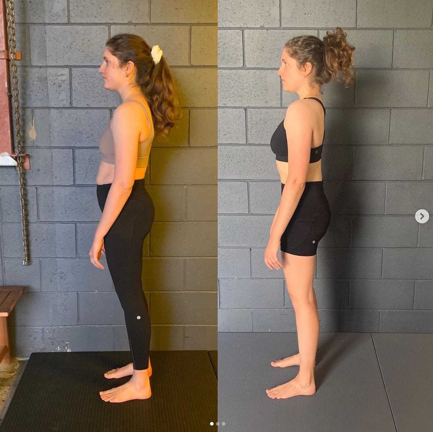 Customer photo review of Instant Posture Corrector