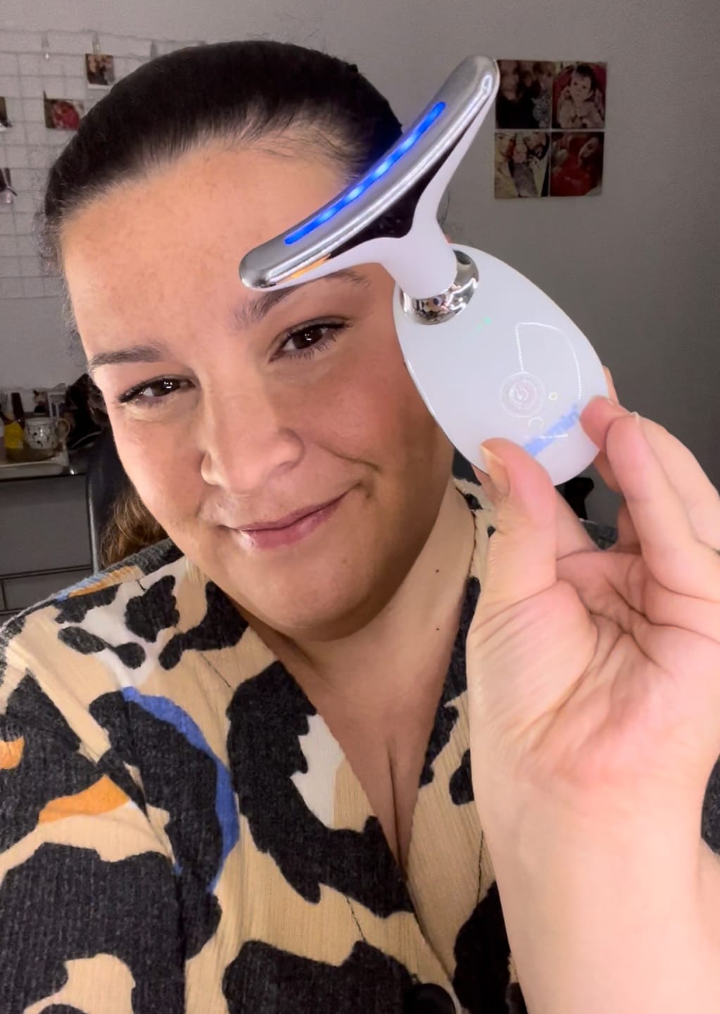 Customer photo review of Reductor de Arrugas Iluminex 3.0 Blumin