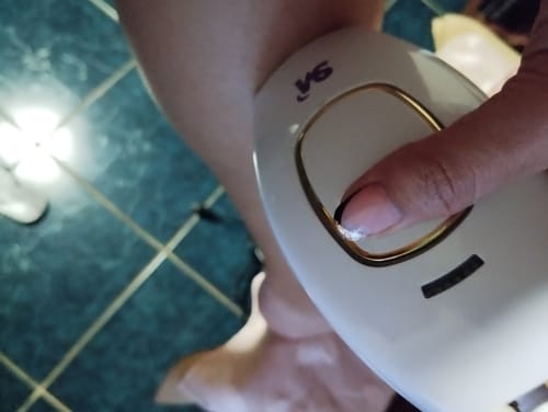 Customer photo review of Depiladora Premium IPL