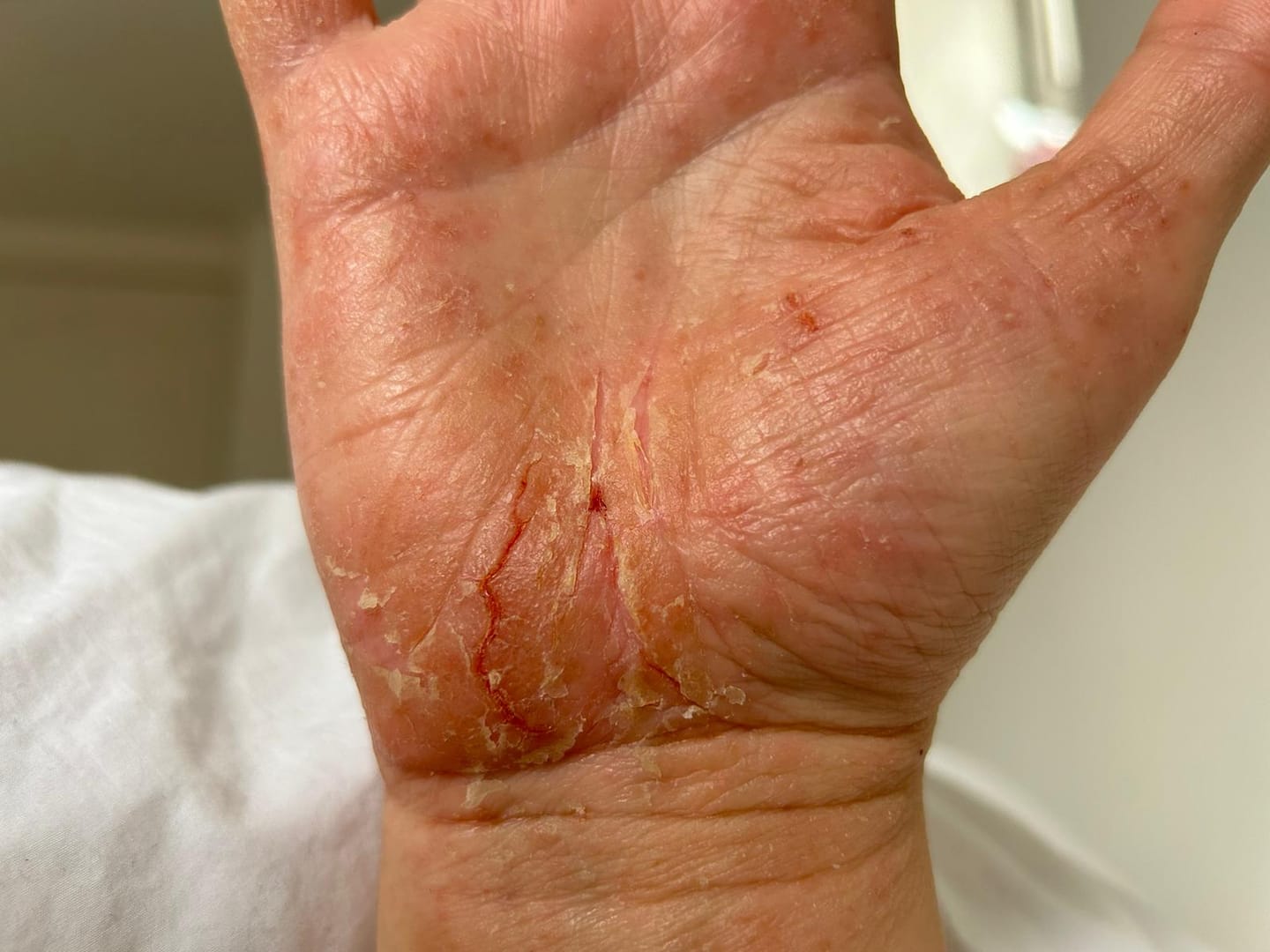 Customer photo review of Prebiotic Hand Cream
