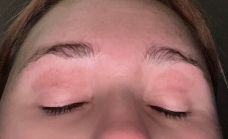 Customer photo review of Purely Lashes Lash Growth Serum