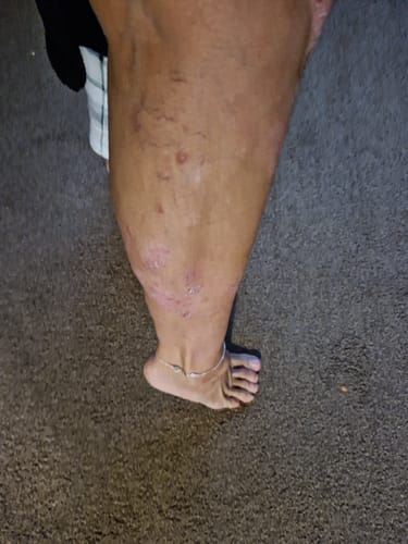 Customer photo review of Multi Strain Biotic