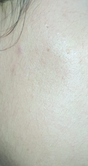 Customer photo review of VIT C GLOW BOOSTER - Vitamin Nectar Moisturizer