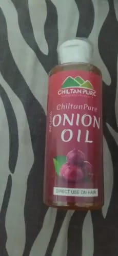 Customer photo review of Red Onion Oil 🧅 Reduces Hair Fall & Accelerates Hair Regrowth [پیاز کا تیل].. Trending.... 🔥