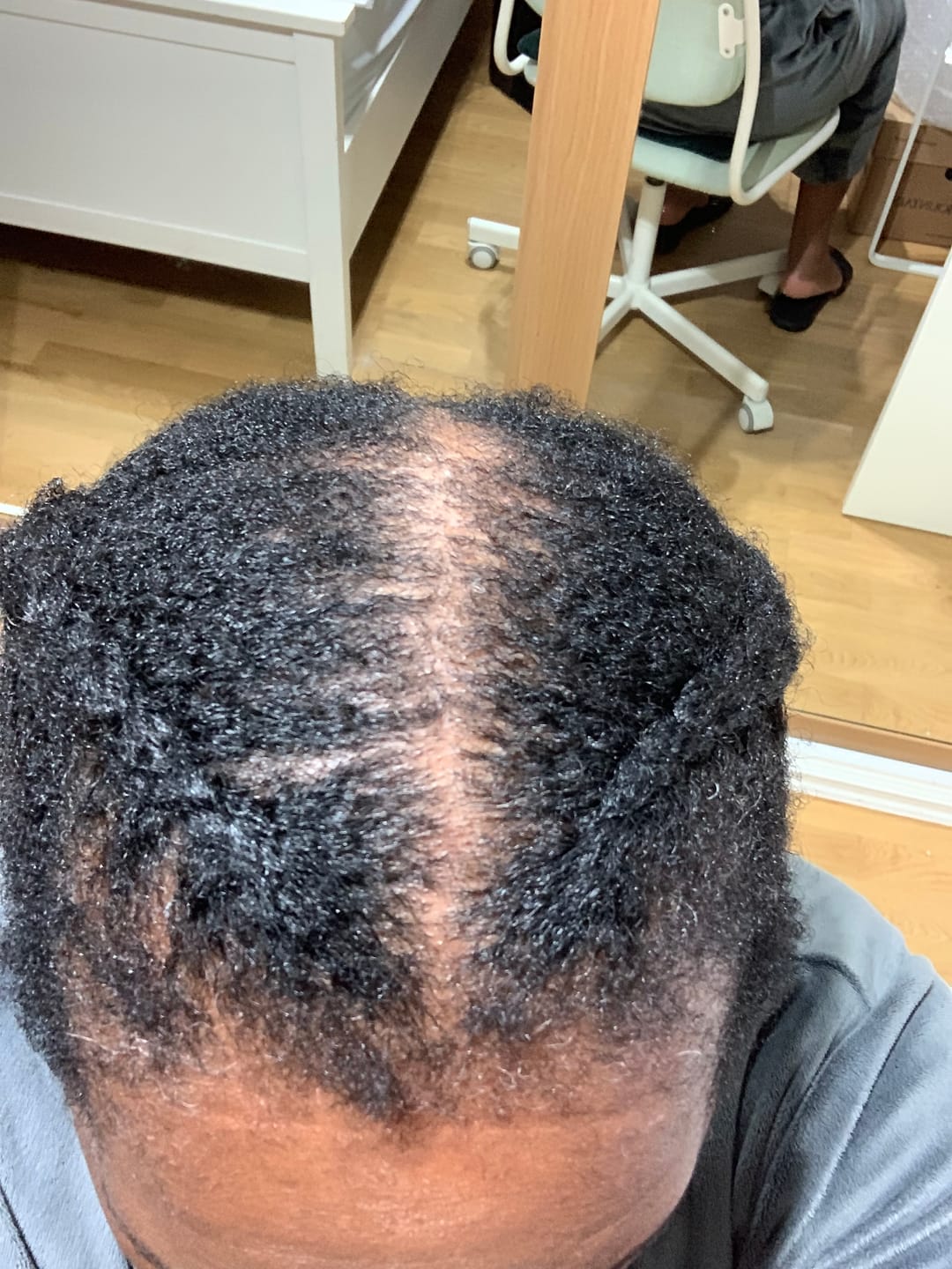 Customer photo review of Hair Growth Potion - Extra Strength
