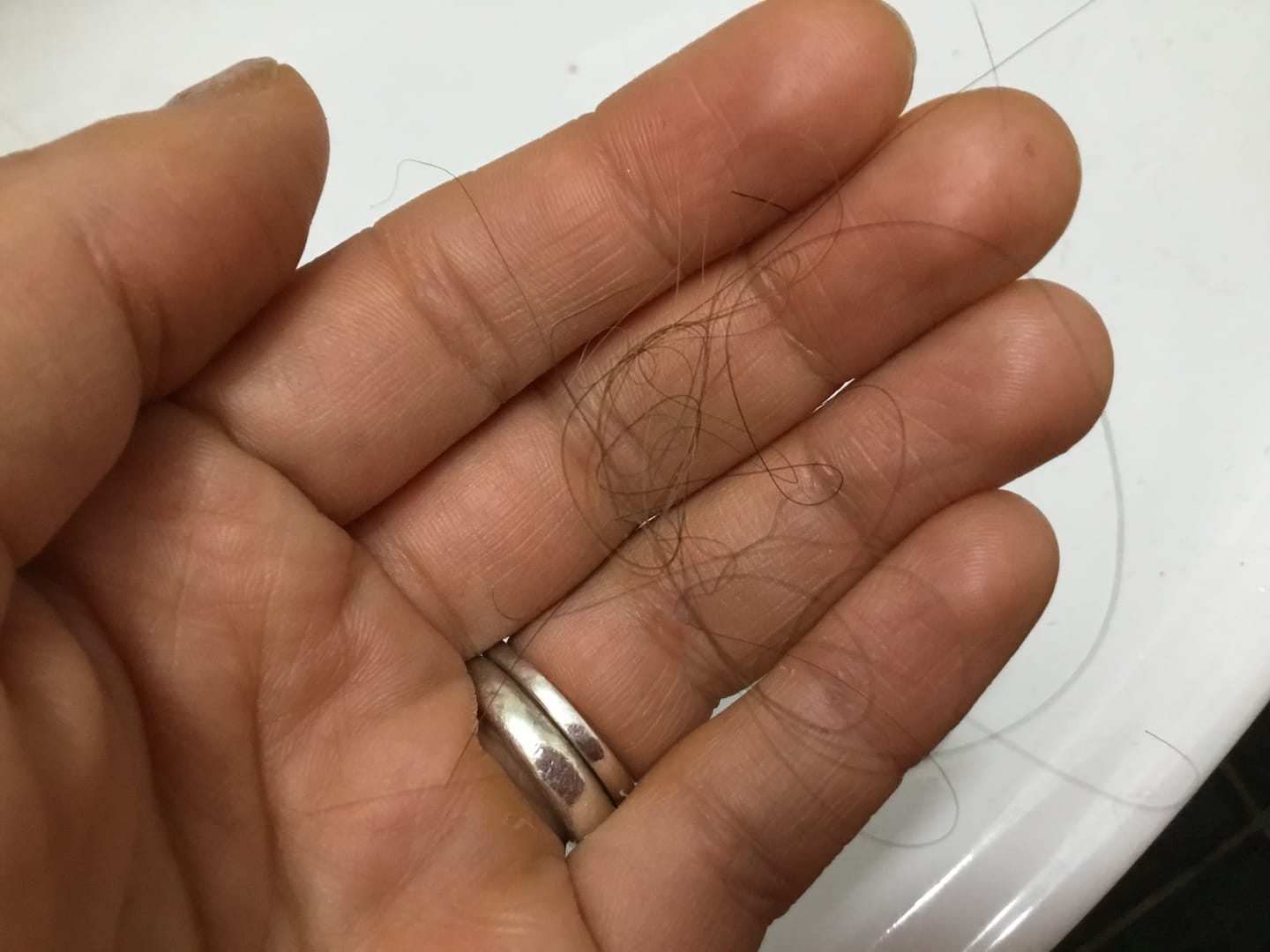 Customer photo review of Anticaída para 3 meses
