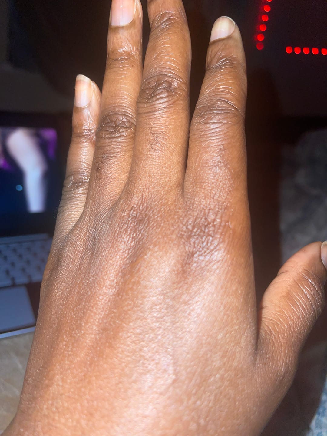 Customer photo review of Fair and White So Carrot Brightening and Nourishing Oil 250ml / 8.4 fl oz