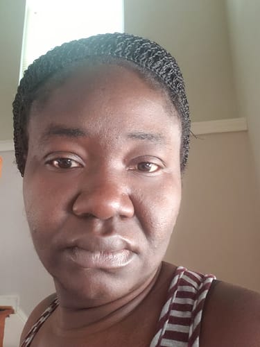 Customer photo review of Turmeric Glow wash for black spots,acne & glow