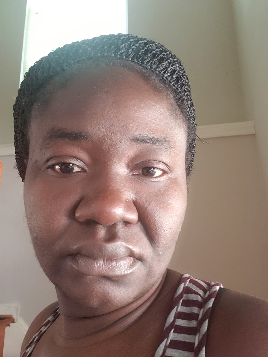 Customer photo review of Turmeric Glow wash for black spots,acne & glow