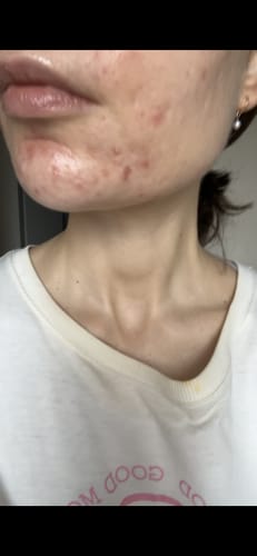 Customer photo review of Core Collection