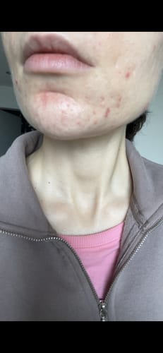 Customer photo review of Core Collection