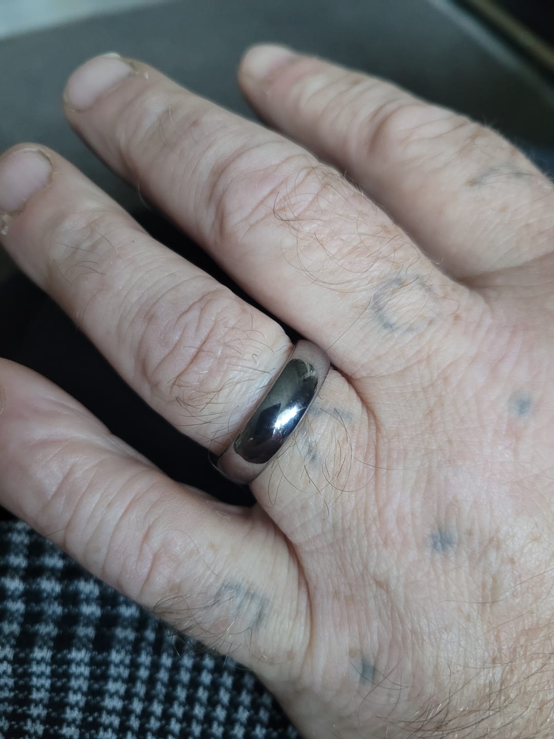 Customer photo review of Original Wonder Ring Set
