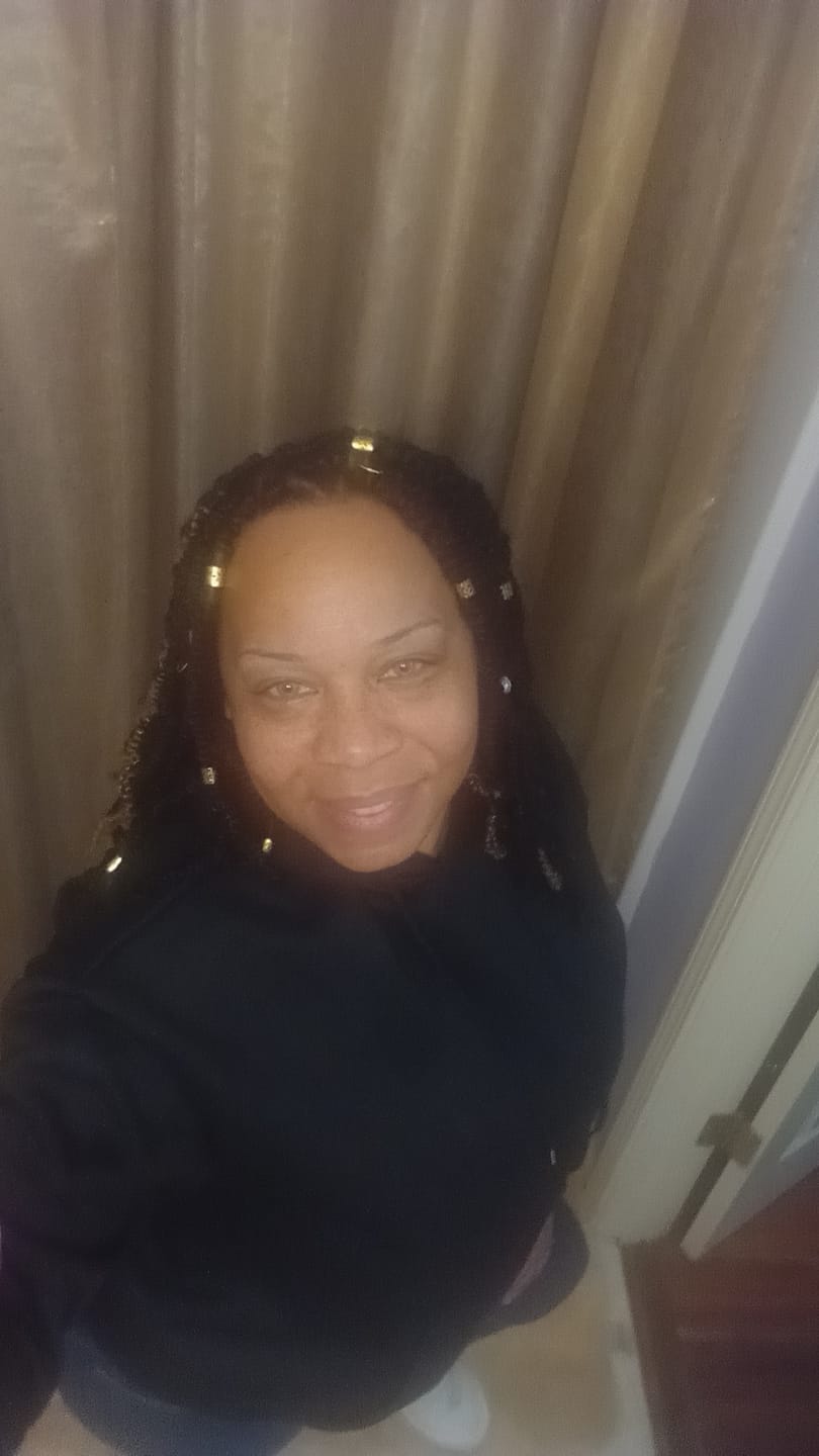 Customer photo review of Wildcat Green Prescription Colored Contact Lenses
