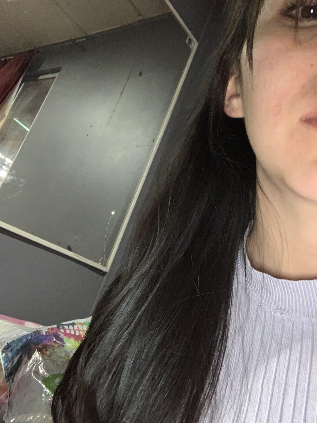 Customer photo review of Tratamiento anticaída 1 mes + Biotina