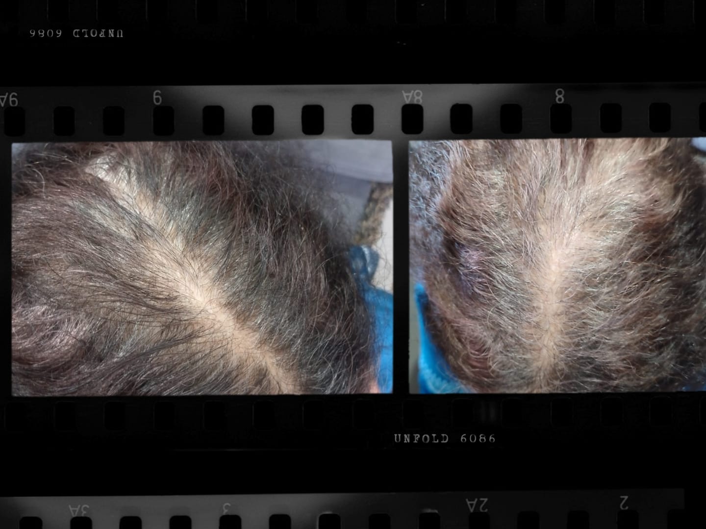 Customer photo review of DO OR DYE - Pro Root Touch-up Hair Stick