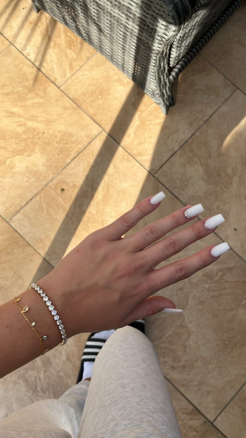 Customer photo review of Luxury Armband | 18K vergoldet