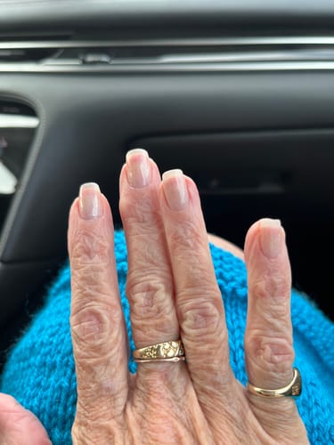 Customer photo review of The Nail Starter Kit