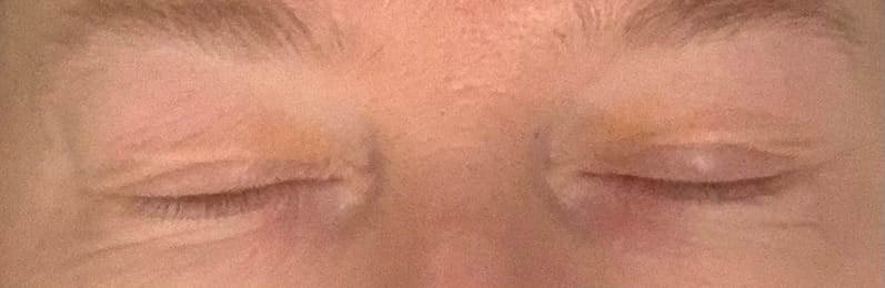 Customer photo review of Eyelash Growth Serum + Mascara Growth Serum