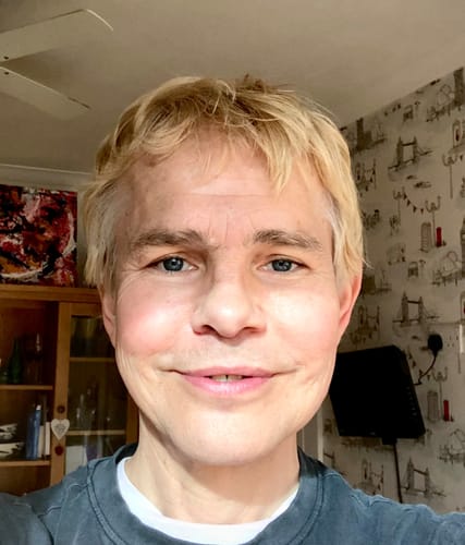 Customer photo review of Hyaluronic Acid Supplement