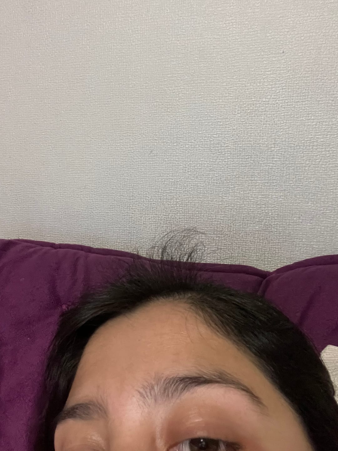 Customer photo review of Tónico anticaída + shampoo anticaída en barra