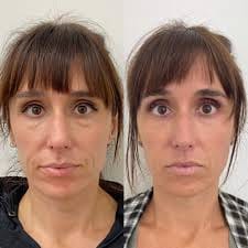 Customer photo review of Bliss™ Collageen Proteine