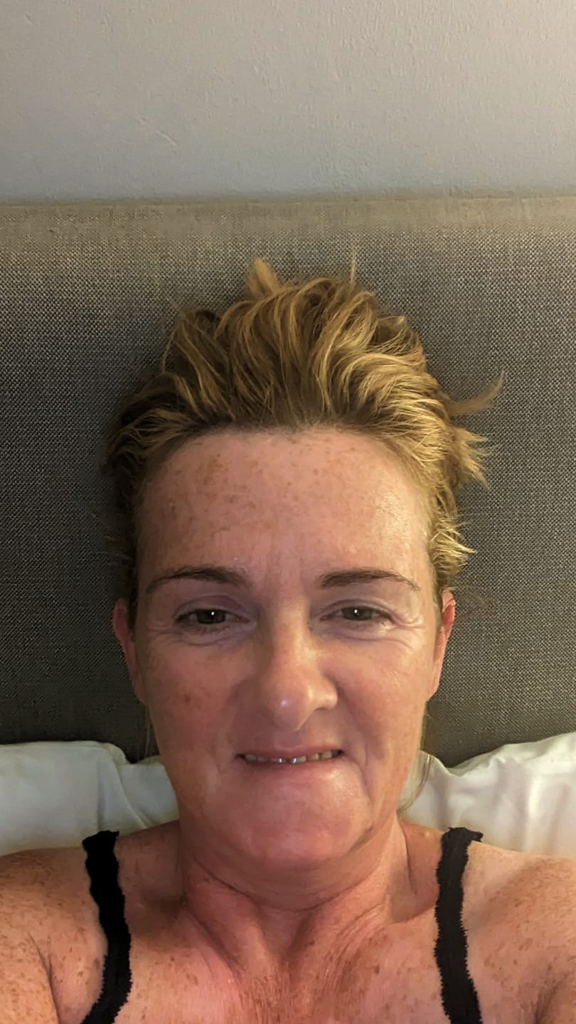 Customer photo review of Mature Skin Cream