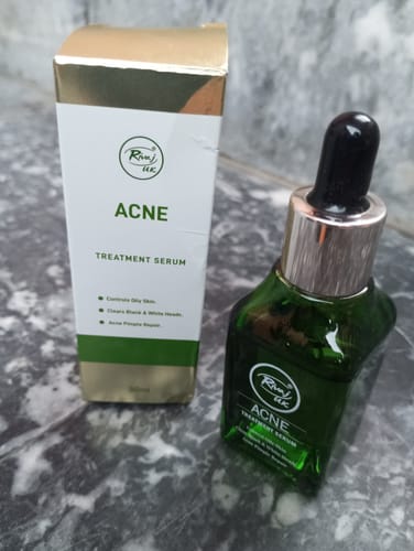Customer photo review of Face Serum - Acne Treatment (30ml)