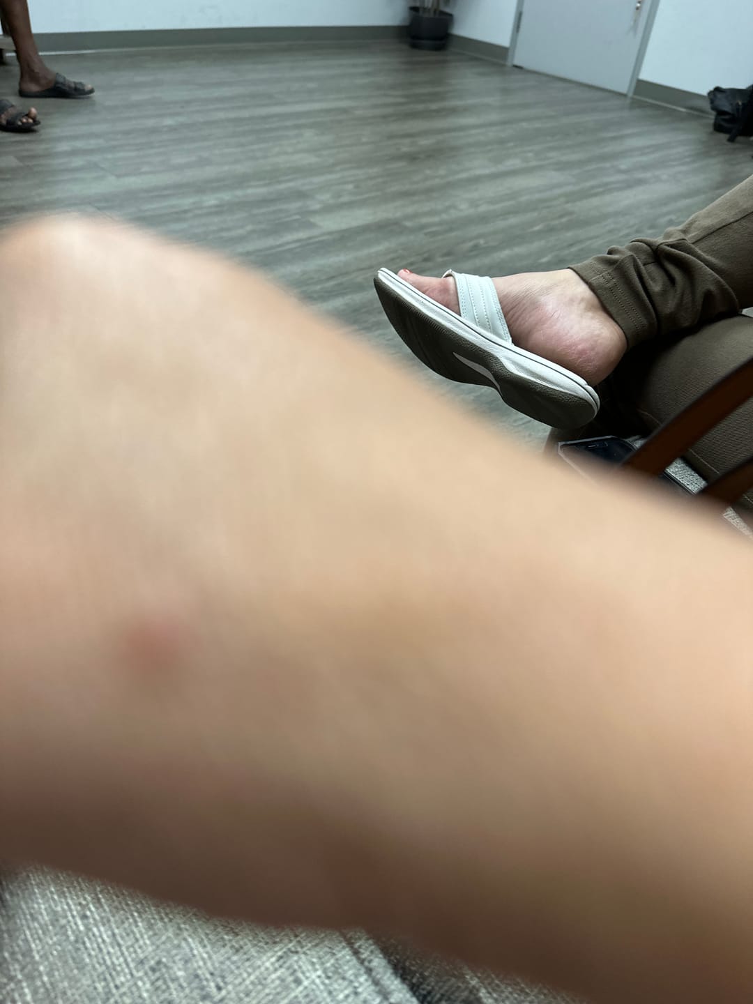 Customer photo review of "No Bite Me!" Bug Repellant Cream