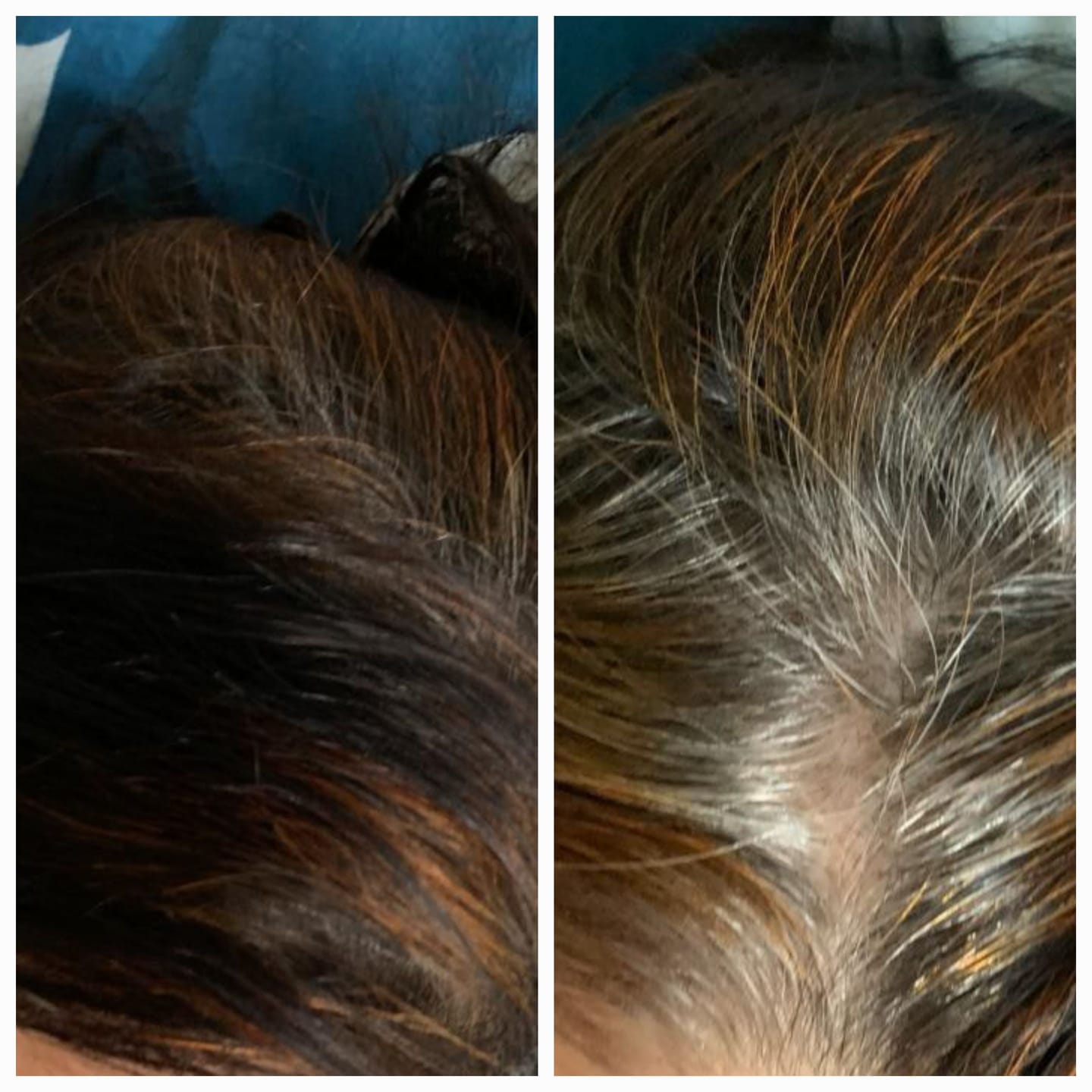 Customer photo review of DO OR DYE - Pro Root Touch-up Hair Stick