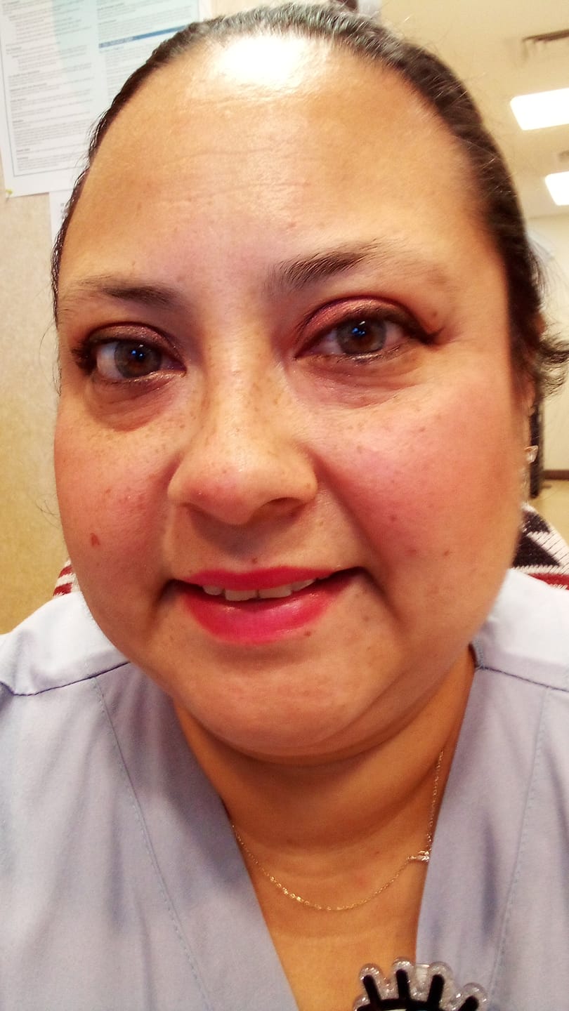 Customer photo review of Premium Candy Gray Prescription Colored Contact Lenses