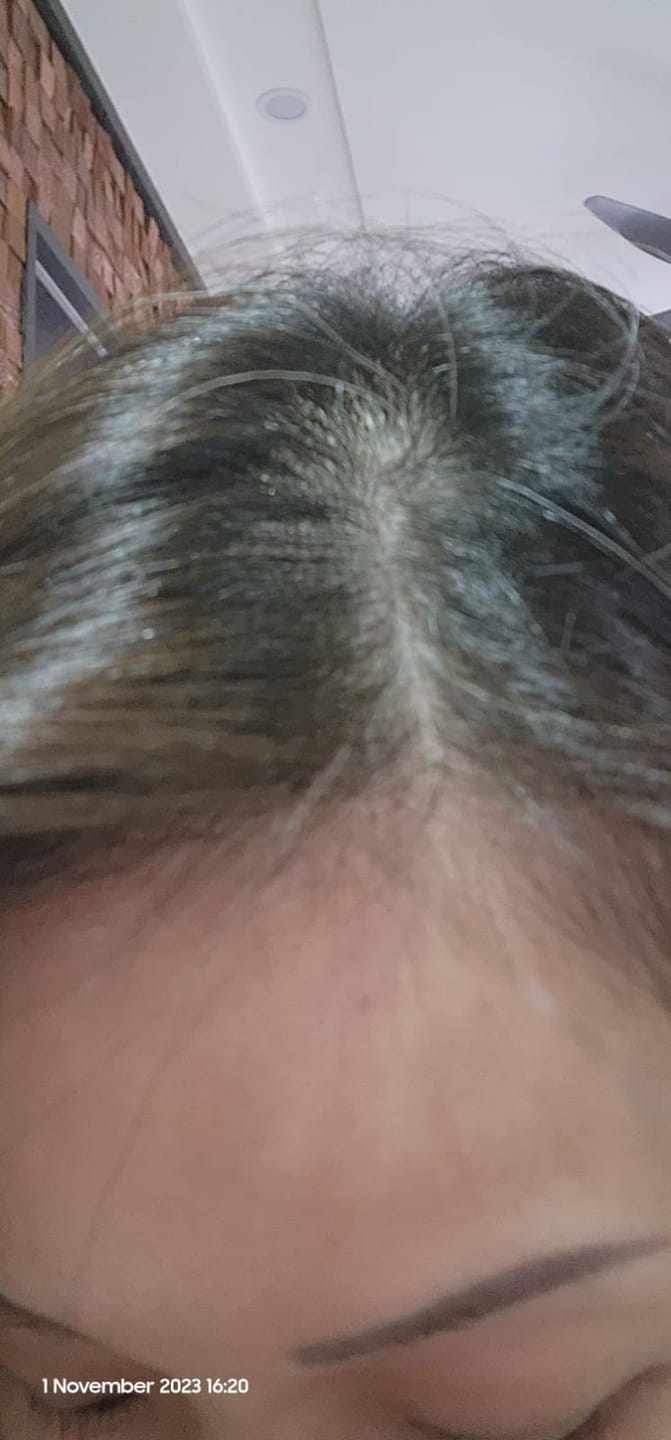 Customer photo review of [ SMIB ] - 500ML Coral Calcium Shampoo