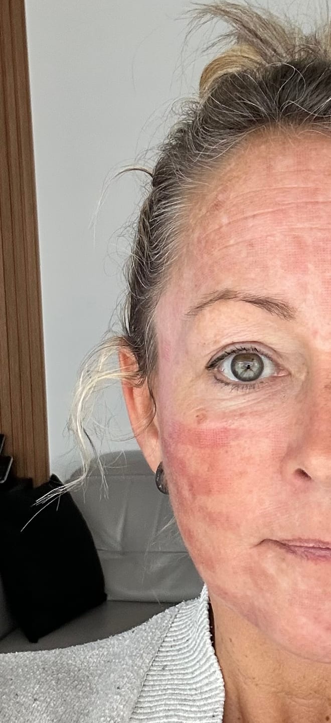 Customer photo review of Protection solaire Face Shield FLEX FPS 50
