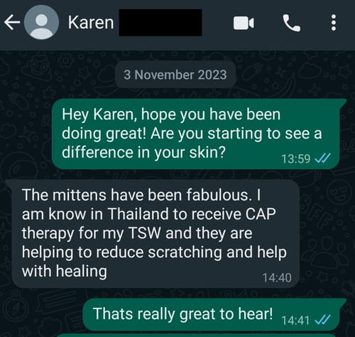 Customer photo review of Eczema Scratch Mitten