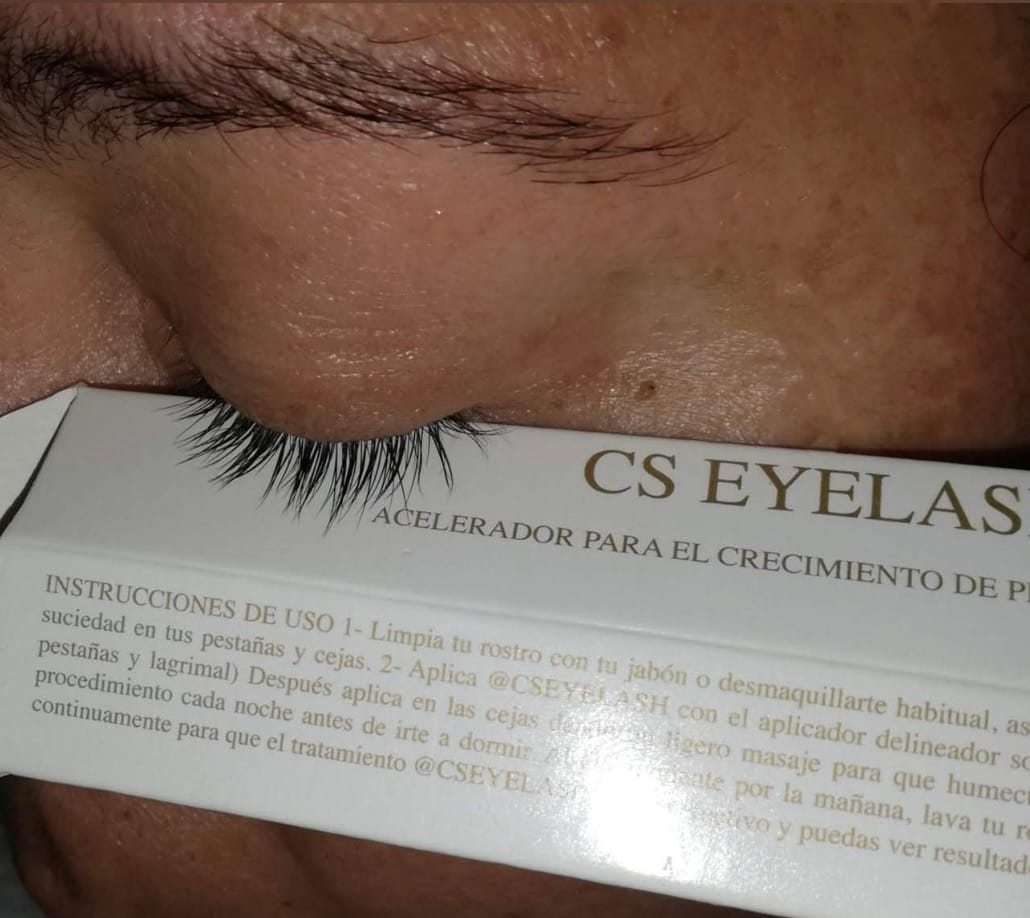 Customer photo review of CS EYELASH- Suero crecimiento de pestañas y cejas