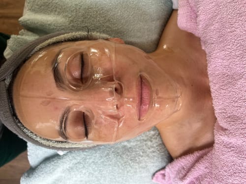 Customer photo review of The CryoPeptide 20 Pack