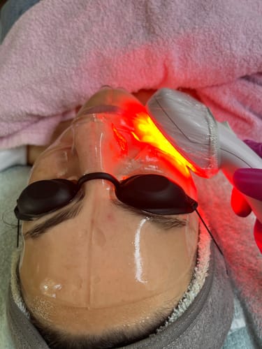 Customer photo review of The CryoPeptide 20 Pack