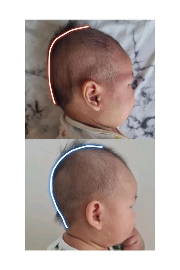 Customer photo review of BSB Head Shaping Pillow ( Upgrade.Ver )