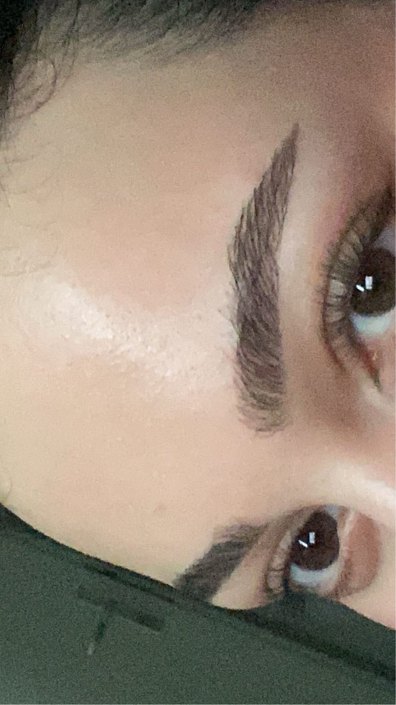 Customer photo review of VORBESTELLUNG: Salicylsäure BHA 2% 50 ml