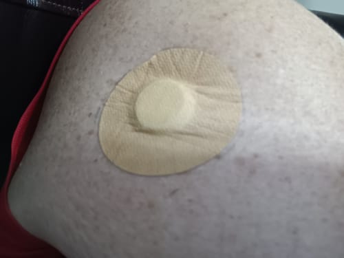 Customer photo review of Skin Grip MAX Freestyle Libre Patches