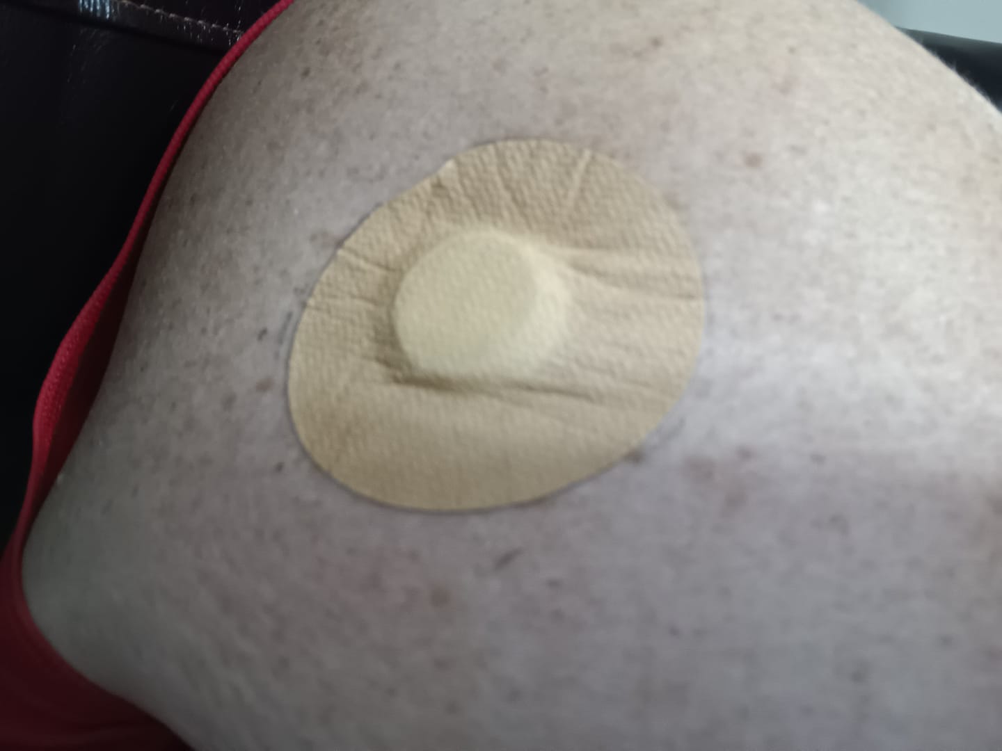 Customer photo review of Skin Grip MAX Freestyle Libre Patches