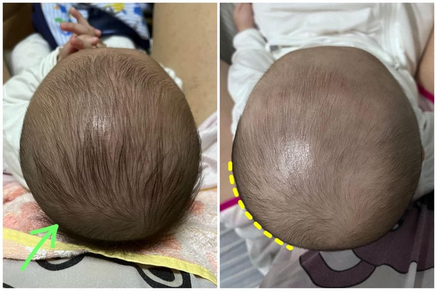Customer photo review of BSB Head Shaping Pillow ( Upgrade.Ver )